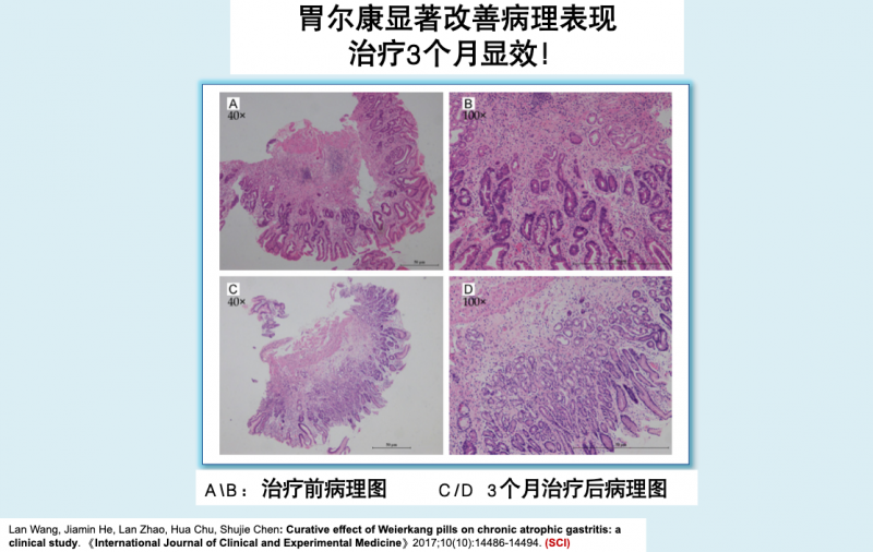 胃尔康片：不仅缓解症状，更能显著改善病理状态