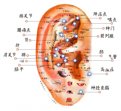 华汉针神耳穴全息疗法开启神经衰弱治疗新篇